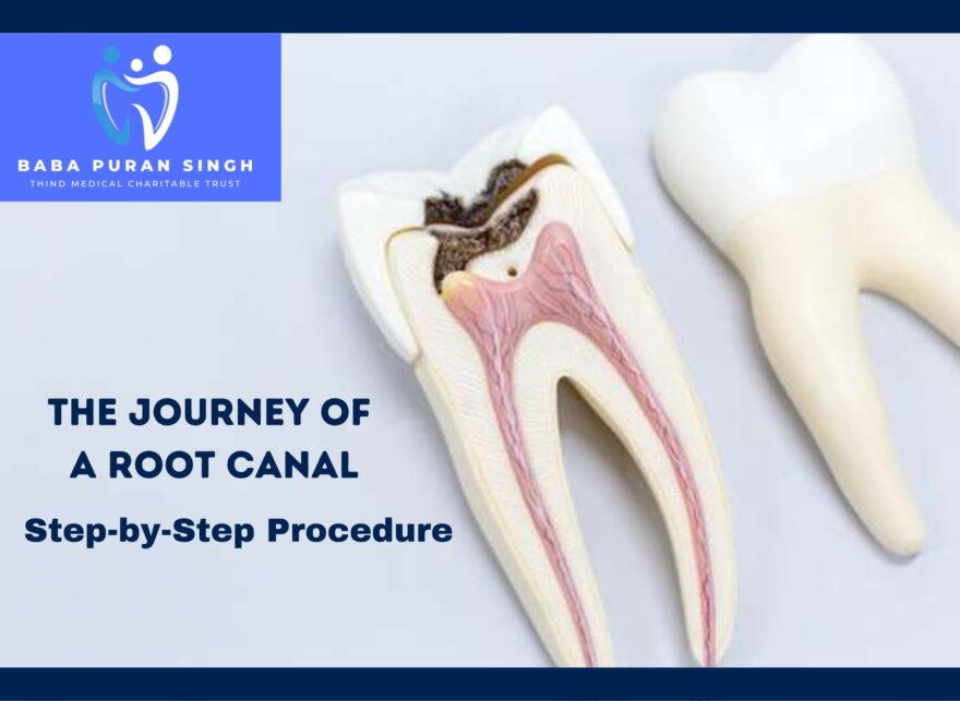 Affordable dental care Ludhiana, Dental charitable trust Ludhiana, Accessible dental services, Ludhiana dental health, Medical charitable trust Ludhiana, Affordable oral hygiene, Ludhiana dental charitable trust, charitable trust Ludhiana, Dental cost assistance, Baba Puran Singh Trust dental care